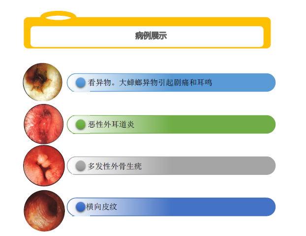 T9316耳鼻医疗内窥镜